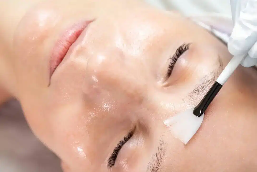 Ενυδάτωση Προσώπου με Υπέρηχους