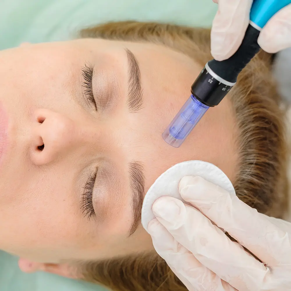 Ενυδάτωση Προσώπου με Υπέρηχους